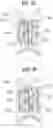 Fig. 13 - Prosthetic heart valve