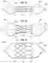 Fig. 27 - Prosthetic heart valve