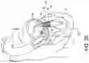 Fig. 07 - Transcatheter atrio-ventricular valve prosthesis