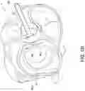Fig. 25 - Transcatheter atrio-ventricular valve prosthesis