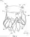 Fig. 11 - VALVE POSITIONING DEVICE