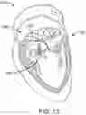 Fig. 15 - VALVE POSITIONING DEVICE
