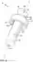 Fig. 03 - Temporomandibular joint implants and methods of treating a temporomandibular joint