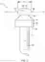 Fig. 04 - Temporomandibular joint implants and methods of treating a temporomandibular joint