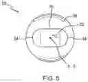 Fig. 06 - Temporomandibular joint implants and methods of treating a temporomandibular joint