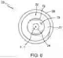 Fig. 07 - Temporomandibular joint implants and methods of treating a temporomandibular joint