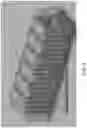 Fig. 03 - Expanding, conforming interbody spacer
