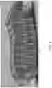 Fig. 06 - Expanding, conforming interbody spacer
