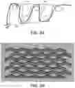 Fig. 09 - Expanding, conforming interbody spacer