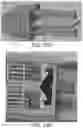 Fig. 22 - Expanding, conforming interbody spacer