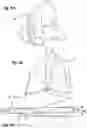 Fig. 05 - Modular knee prosthesis