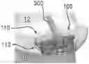 Fig. 01 - Expandable intervertebral implant