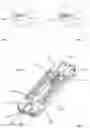 Fig. 02 - Spinal fusion device with staged expansion