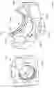 Fig. 112 - Spinal fusion device with staged expansion