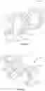 Fig. 134 - Spinal fusion device with staged expansion