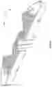 Fig. 147 - Spinal fusion device with staged expansion