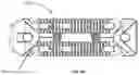 Fig. 153 - Spinal fusion device with staged expansion