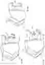 Fig. 27 - Spinal fusion device with staged expansion