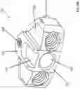 Fig. 40 - Spinal fusion device with staged expansion