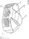 Fig. 46 - Spinal fusion device with staged expansion