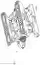 Fig. 79 - Spinal fusion device with staged expansion