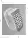 Fig. 158 - Spinal implant device