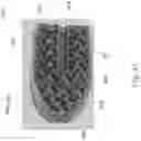 Fig. 40 - Spinal implant device