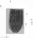 Fig. 43 - Spinal implant device