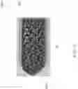 Fig. 46 - Spinal implant device
