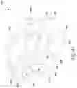 Fig. 57 - Spinal implant device
