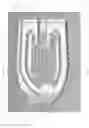Fig. 83 - Spinal implant device