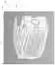 Fig. 85 - Spinal implant device