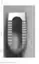 Fig. 92 - Spinal implant device