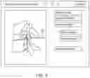 Fig. 06 - Robot assisted intervertebral disc prosthesis selection and implantation system