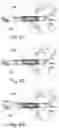 Fig. 04 - PERCUTANEOUS HEART VALVE