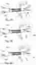 Fig. 05 - PERCUTANEOUS HEART VALVE