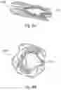 Fig. 09 - PERCUTANEOUS HEART VALVE
