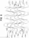 Fig. 05 - Stent with shaped wires