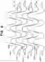 Fig. 06 - Stent with shaped wires