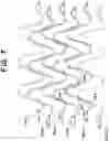 Fig. 07 - Stent with shaped wires