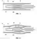 Fig. 07 - Expandable exoskeleton devices