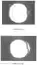 Fig. 22 - BIODEGRADABLE ENDOPROSTHESES AND METHODS FOR THEIR FABRICATION
