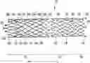 Fig. 01 - STENT