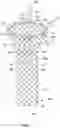 Fig. 02 - Repositionable and removable stents