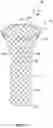 Fig. 03 - Repositionable and removable stents