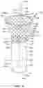 Fig. 05 - Repositionable and removable stents