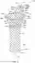 Fig. 12 - Repositionable and removable stents