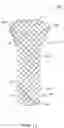Fig. 14 - Repositionable and removable stents