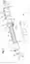 Fig. 02 - DEPLOYMENT HANDLE WITH STABILIZING SHELLS FOR A PRE-LOADED PROSTHESIS DELIVERY DEVICE
