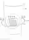 Fig. 01 - DEVICE FOR MANAGING PATELLOFEMORAL PAIN AND METHODS OF USE THEREOF